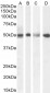 Goat Anti-SEPT6 Antibody