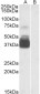 Goat Anti-P2RX7 / P2X7 receptor Antibody