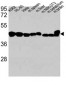 Beta-Actin  Antibody