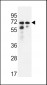 PNPLA8 Antibody (N-term)
