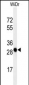 PAQR3 Antibody (C-term)