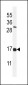 IFM2 Antibody  (N-term)