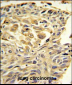 ZO1 Antibody (C-term)