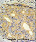 ZNF9 Antibody (Center)
