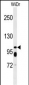 ABCC11 Antibody (N-term)