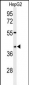 WDR82 Antibody (N-term)