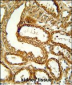 CCR1 Antibody (N-term)