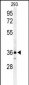 CCR1 Antibody (N-term)