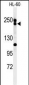 BLM Antibody (C-term)