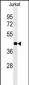 ATF1 Antibody (C-term)