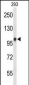 DDX23 Antibody (Center)
