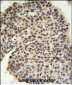 PRPF19 Antibody (N-term)