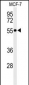 PRPF19 Antibody (N-term)