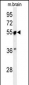 PRPF19 Antibody (N-term)