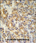 TXNDC12 Antibody (C-term)