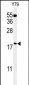 TXNDC12 Antibody (C-term)