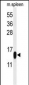 PLA2G1B Antibody (C-term)