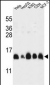 HIST1H2AL Antibody (C-term)