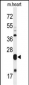 MLF1 Antibody (C-term)