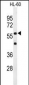 IL2RG Antibody (N-term)