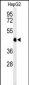 HFE2 Antibody (C-term)