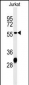 HADHB Antibody (C-term)