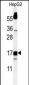 TYROBP Antibody (C-term)
