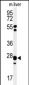 GSTK1 Antibody (Center)