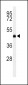 LCAT Antibody (Center)