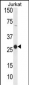 CD160 Antibody (Center)