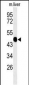 WAS Antibody (Center)