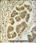 HCCS Antibody (Center)