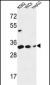 PYCR1 Antibody (C-term)