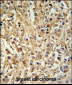 DDX6 Antibody (Center)