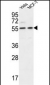 DDX6 Antibody (Center)