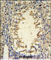 IMP3 Antibody (C-term)
