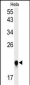 IMP3 Antibody (C-term)