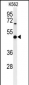 B3GAT1 Antibody (N-term)