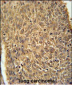 ATG13 Antibody (N-term)