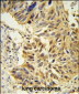 SDR Antibody (Center)