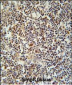 CLM1 Antibody (N-term)