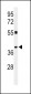 CLM1 Antibody (N-term)