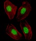 NR1H3 Antibody (Center)