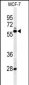 NR1H3 Antibody (Center)