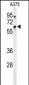 DCT Antibody (N-term)