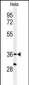 SUMF1 Antibody (C-Term)