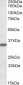 Goat Anti-FGL1 / Hepassocin Antibody