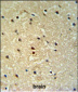 PROX-1-S514 Antibody