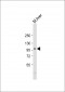 PROX-1-S514 Antibody