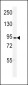 DLG7 Antibody (Center)